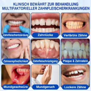 𝐋𝐮𝐱𝐚𝐫𝐢𝐬𝐞® GumRevive Parodontal-Reparaturgel