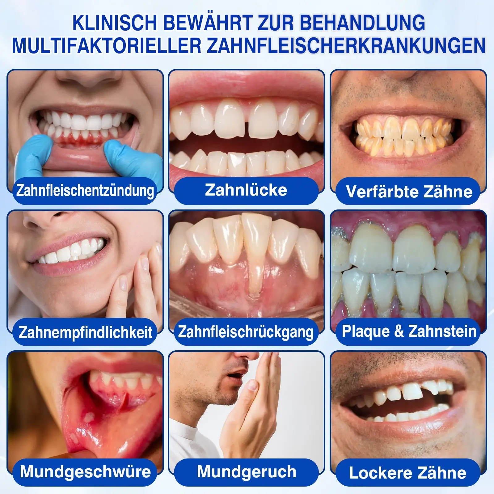 𝐋𝐮𝐱𝐚𝐫𝐢𝐬𝐞® GumRevive Parodontal-Reparaturgel