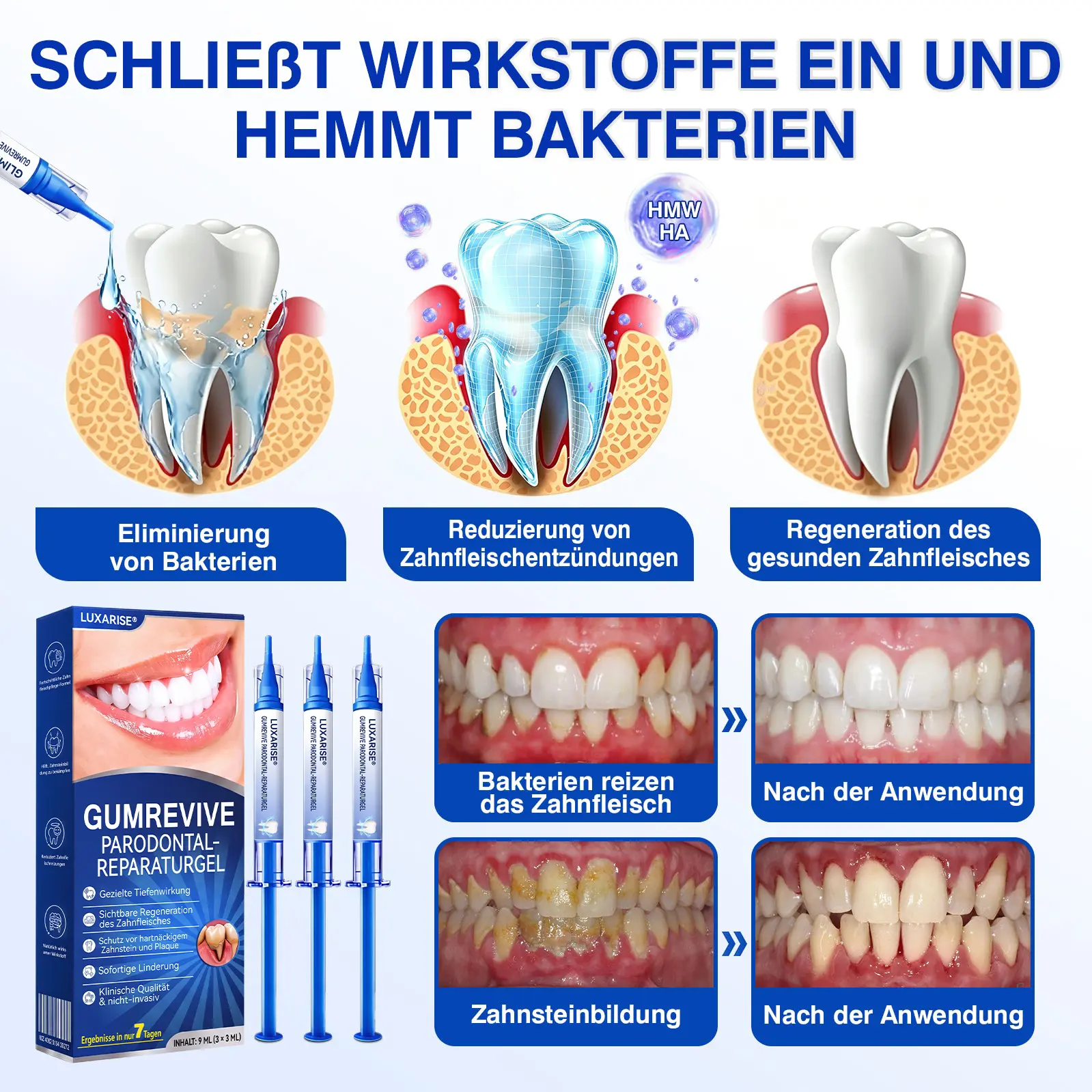 𝐋𝐮𝐱𝐚𝐫𝐢𝐬𝐞® GumRevive Parodontal-Reparaturgel