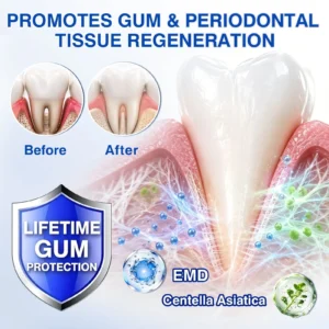 CureVivo® GumRevive Periodontal Repair Gel