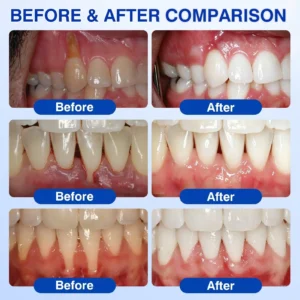 CureVivo® GumRevive Periodontal Repair Gel