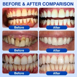 CureVivo® GumRevive Periodontal Repair Gel