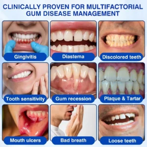 CureVivo® GumRevive Periodontal Repair Gel