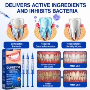 CureVivo® GumRevive Periodontal Repair Gel