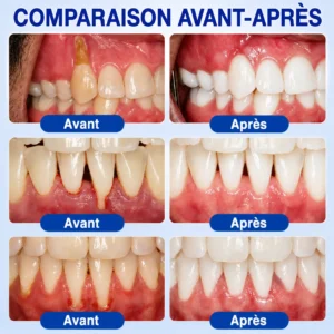 Garageline® GumCare Pro – Soin buccal nocturne de précision