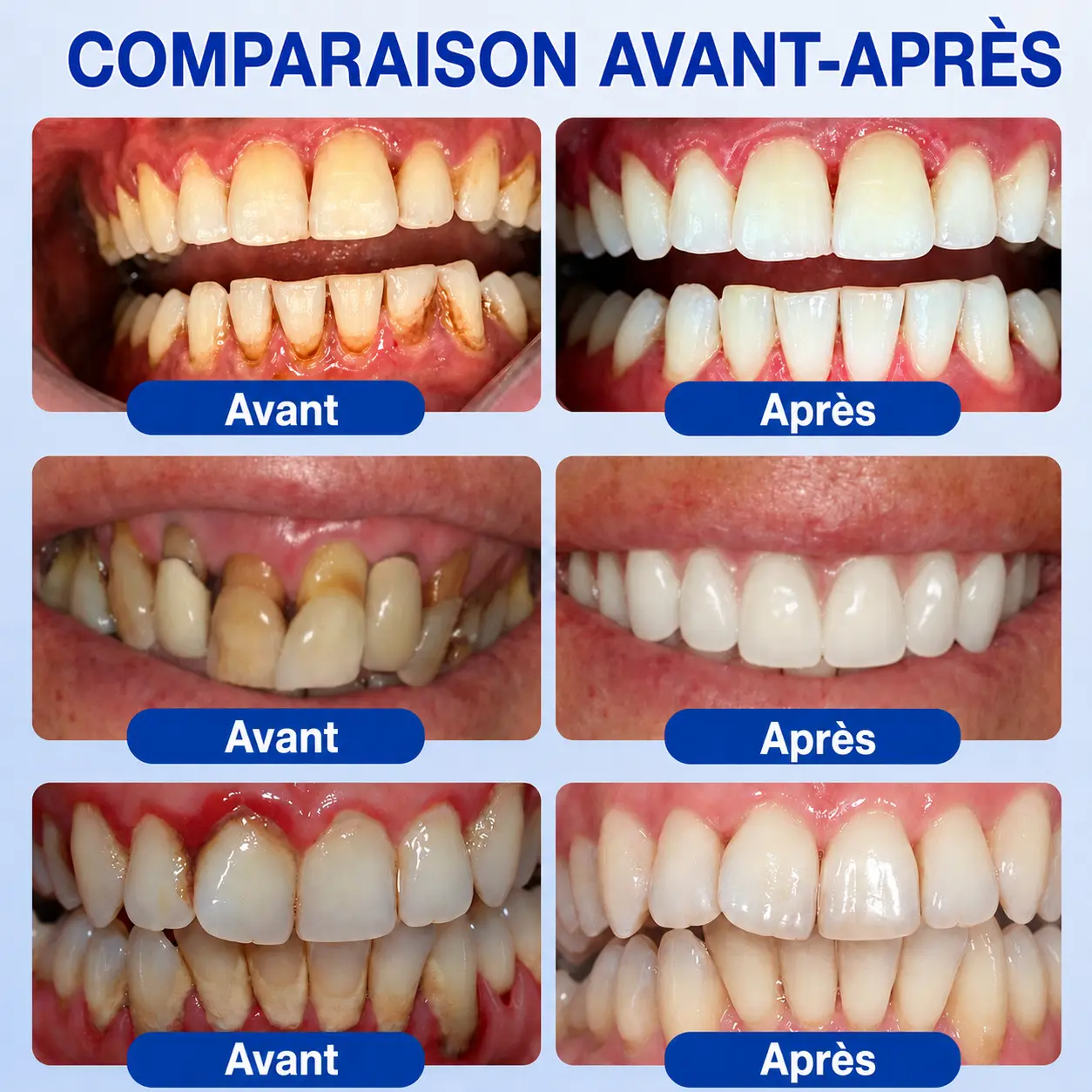 Garageline® GumCare Pro – Soin buccal nocturne de précision