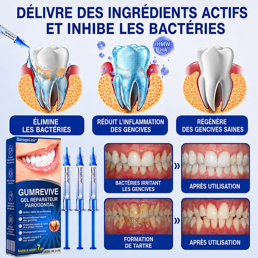 Garageline® GumCare Pro – Soin buccal nocturne de précision