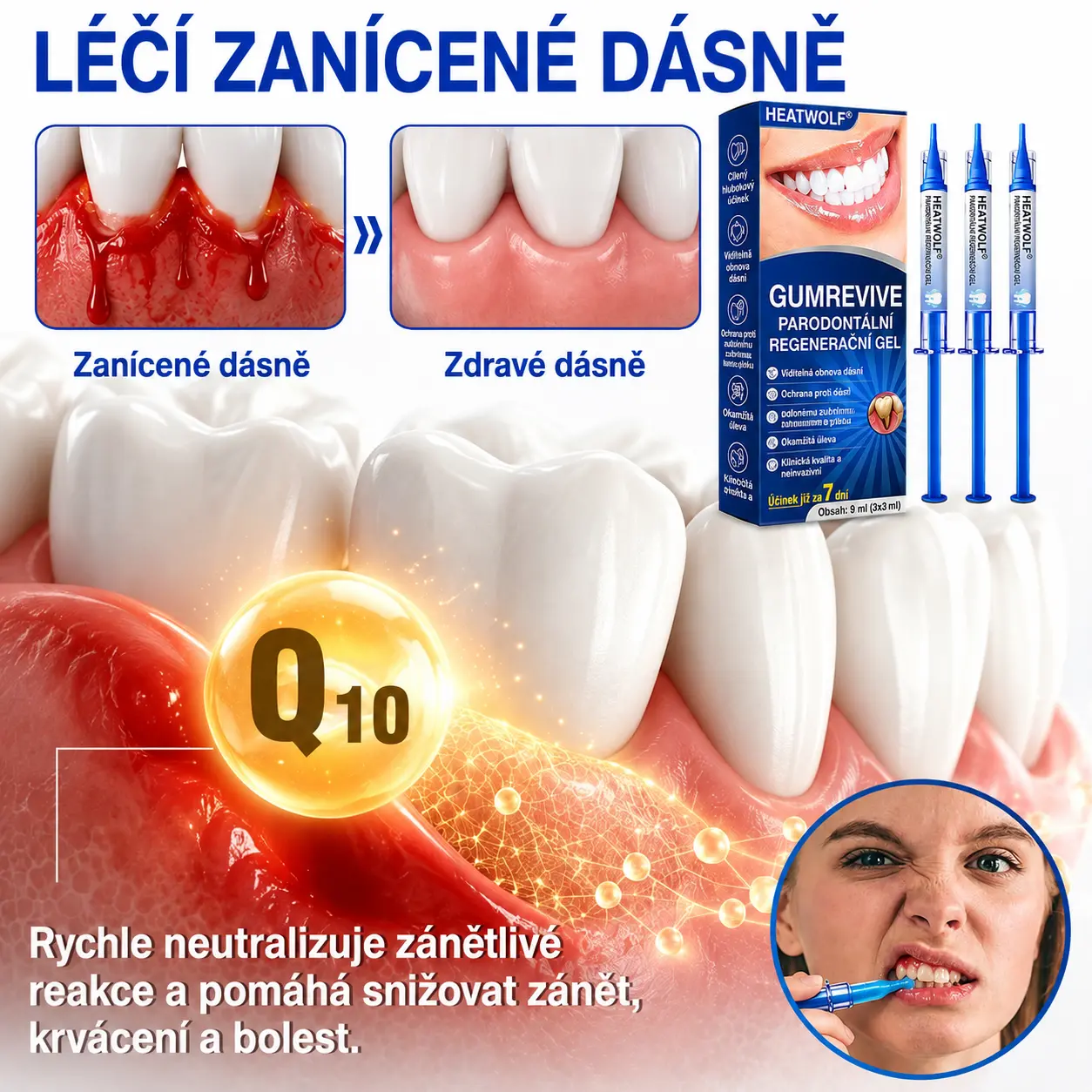 👨🏻⚕️ 𝐇𝐄𝐀𝐓𝐖𝐎𝐋𝐅® 𝐆𝐮𝐦𝐑𝐞𝐯𝐢𝐯𝐞 𝐩𝐚𝐫𝐨𝐝𝐨𝐧𝐭á𝐥𝐧í 𝐨𝐩𝐫𝐚𝐯𝐧ý 𝐠𝐞𝐥