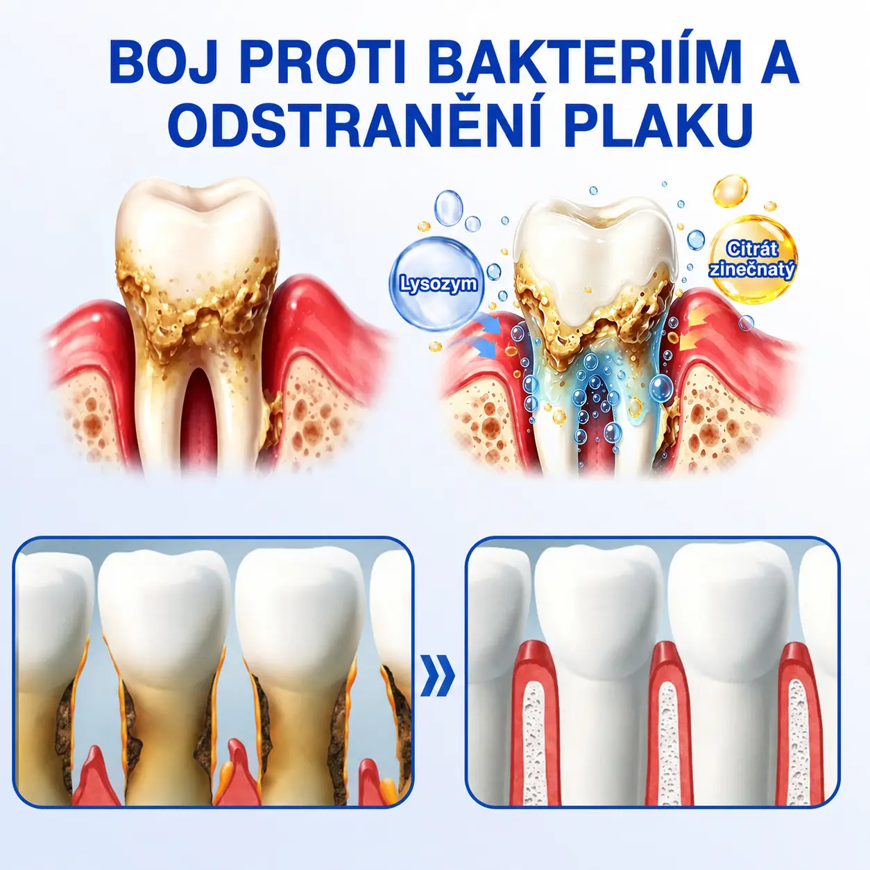 👨🏻⚕️ 𝐇𝐄𝐀𝐓𝐖𝐎𝐋𝐅® 𝐆𝐮𝐦𝐑𝐞𝐯𝐢𝐯𝐞 𝐩𝐚𝐫𝐨𝐝𝐨𝐧𝐭á𝐥𝐧í 𝐨𝐩𝐫𝐚𝐯𝐧ý 𝐠𝐞𝐥