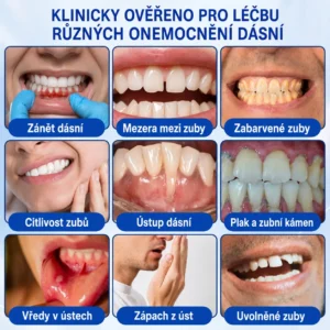 👨🏻⚕️ 𝐇𝐄𝐀𝐓𝐖𝐎𝐋𝐅® 𝐆𝐮𝐦𝐑𝐞𝐯𝐢𝐯𝐞 𝐩𝐚𝐫𝐨𝐝𝐨𝐧𝐭á𝐥𝐧í 𝐨𝐩𝐫𝐚𝐯𝐧ý 𝐠𝐞𝐥