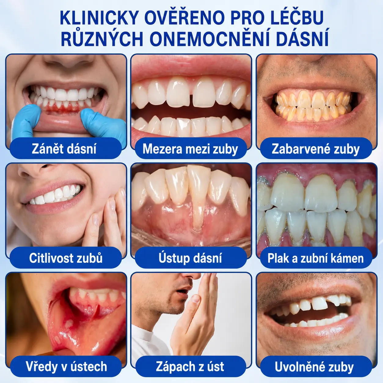👨🏻⚕️ 𝐇𝐄𝐀𝐓𝐖𝐎𝐋𝐅® 𝐆𝐮𝐦𝐑𝐞𝐯𝐢𝐯𝐞 𝐩𝐚𝐫𝐨𝐝𝐨𝐧𝐭á𝐥𝐧í 𝐨𝐩𝐫𝐚𝐯𝐧ý 𝐠𝐞𝐥
