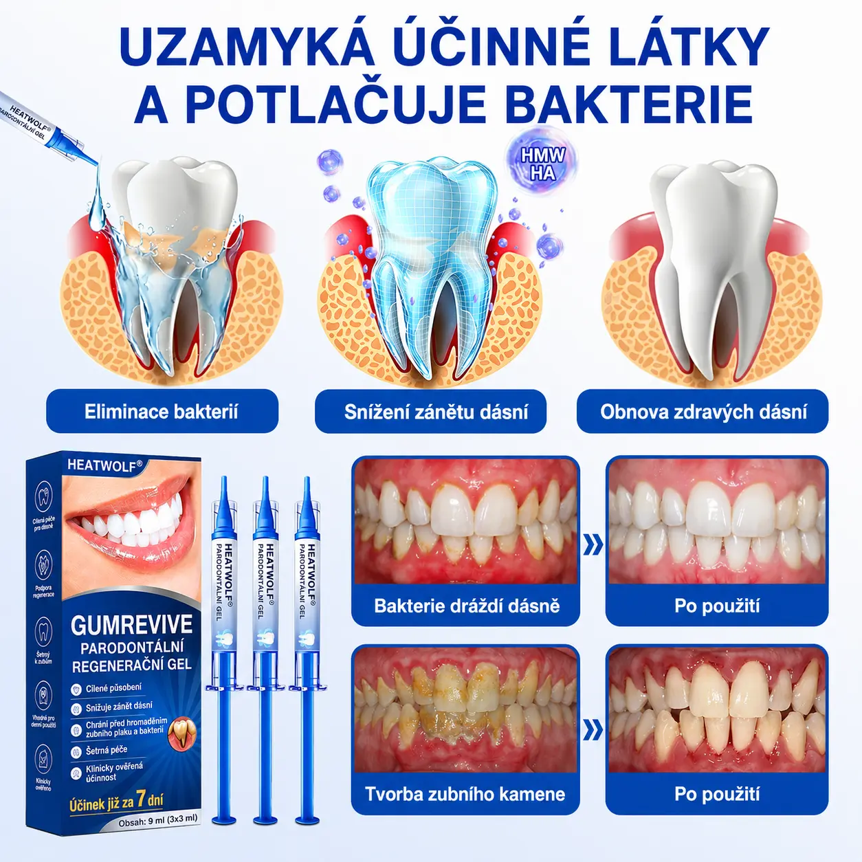 👨🏻⚕️ 𝐇𝐄𝐀𝐓𝐖𝐎𝐋𝐅® 𝐆𝐮𝐦𝐑𝐞𝐯𝐢𝐯𝐞 𝐩𝐚𝐫𝐨𝐝𝐨𝐧𝐭á𝐥𝐧í 𝐨𝐩𝐫𝐚𝐯𝐧ý 𝐠𝐞𝐥