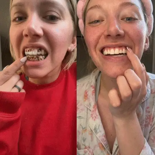 Dr.Era® GumRevive