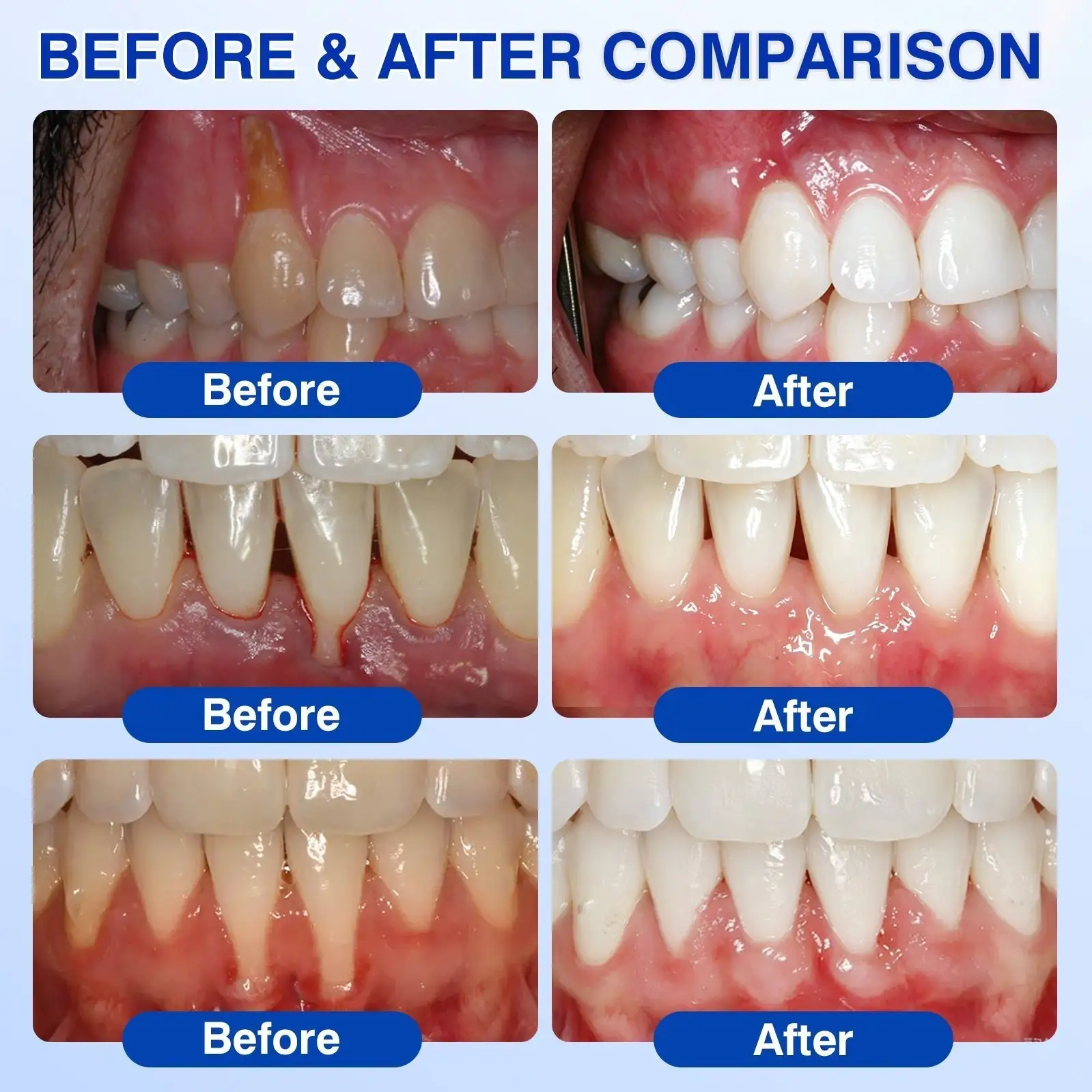 Dr.Era® GumRevive Gum Care Gel