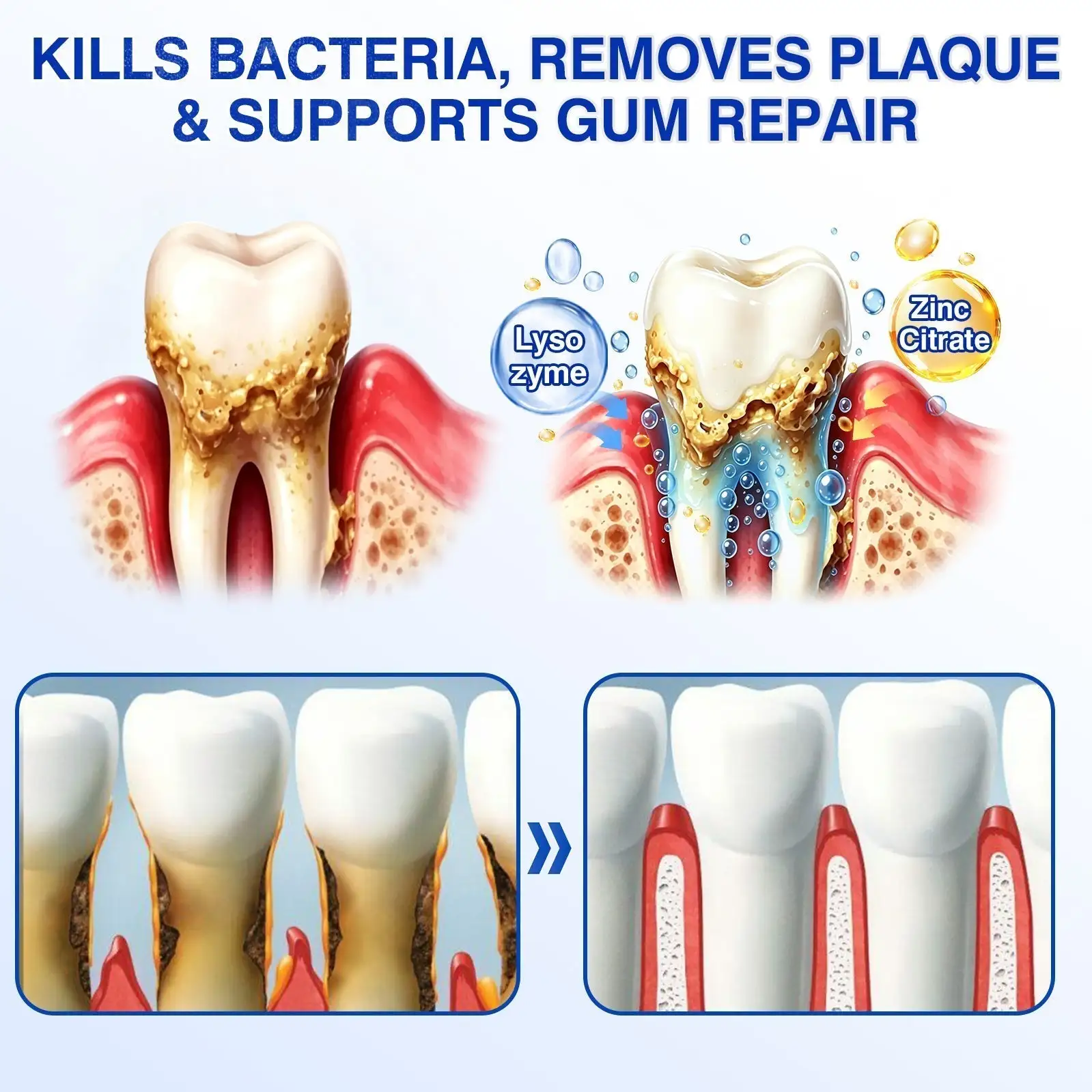 Dr.Era® GumRevive Gum Care Gel