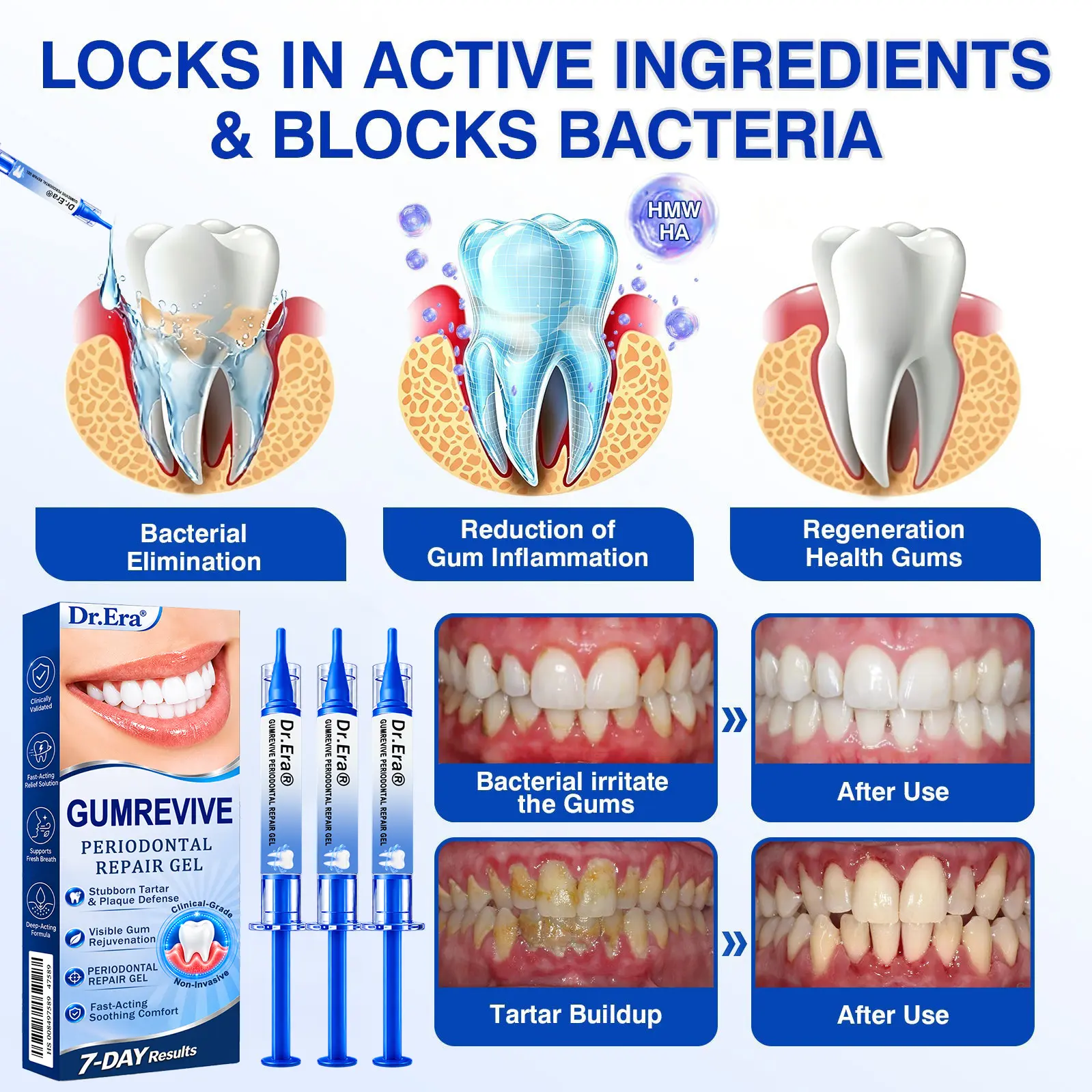 Dr.Era® GumRevive Gum Care Gel
