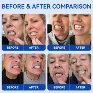 Glimmerly® GumRevive Periodontal Repair Gel