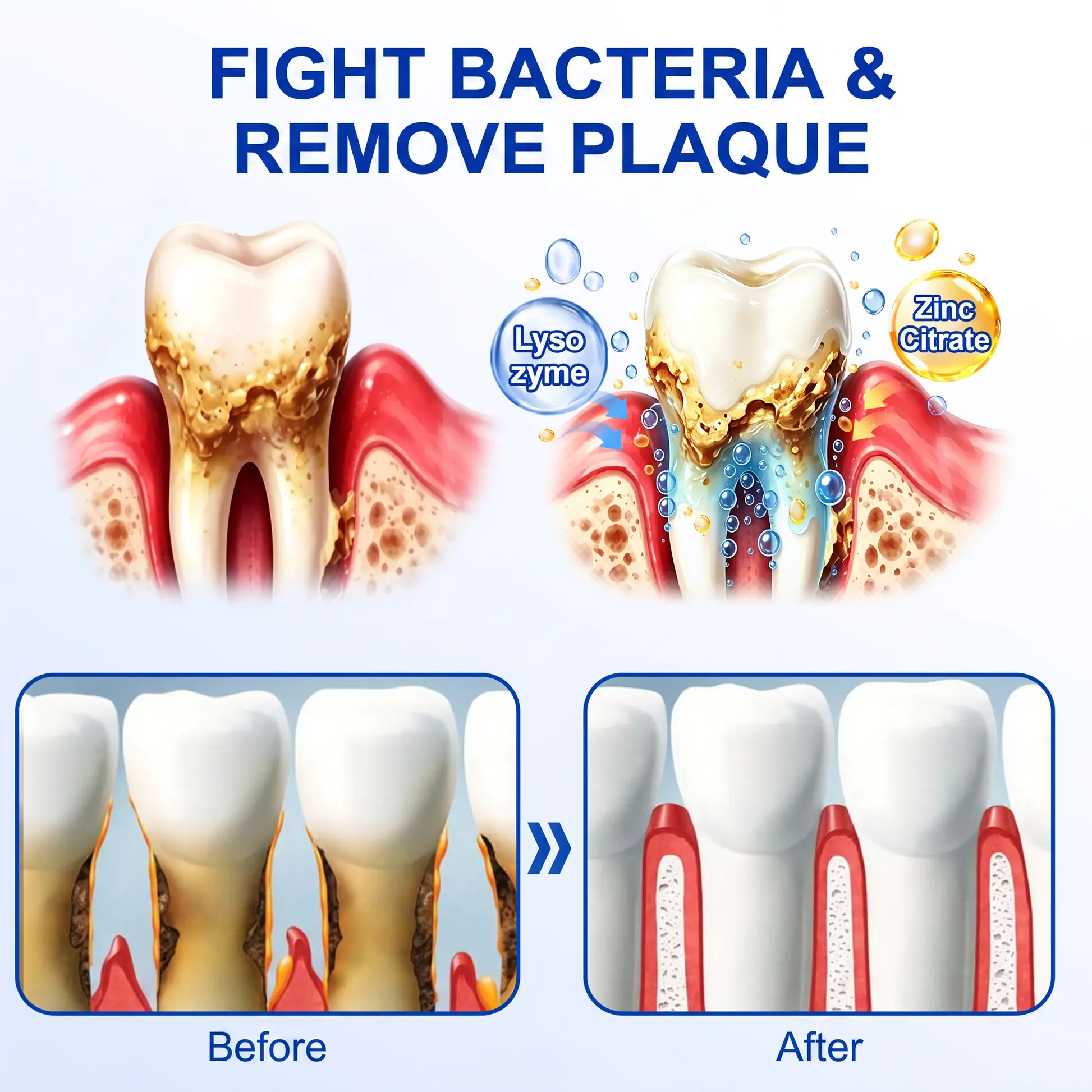 Glimmerly® GumRevive Periodontal Repair Gel
