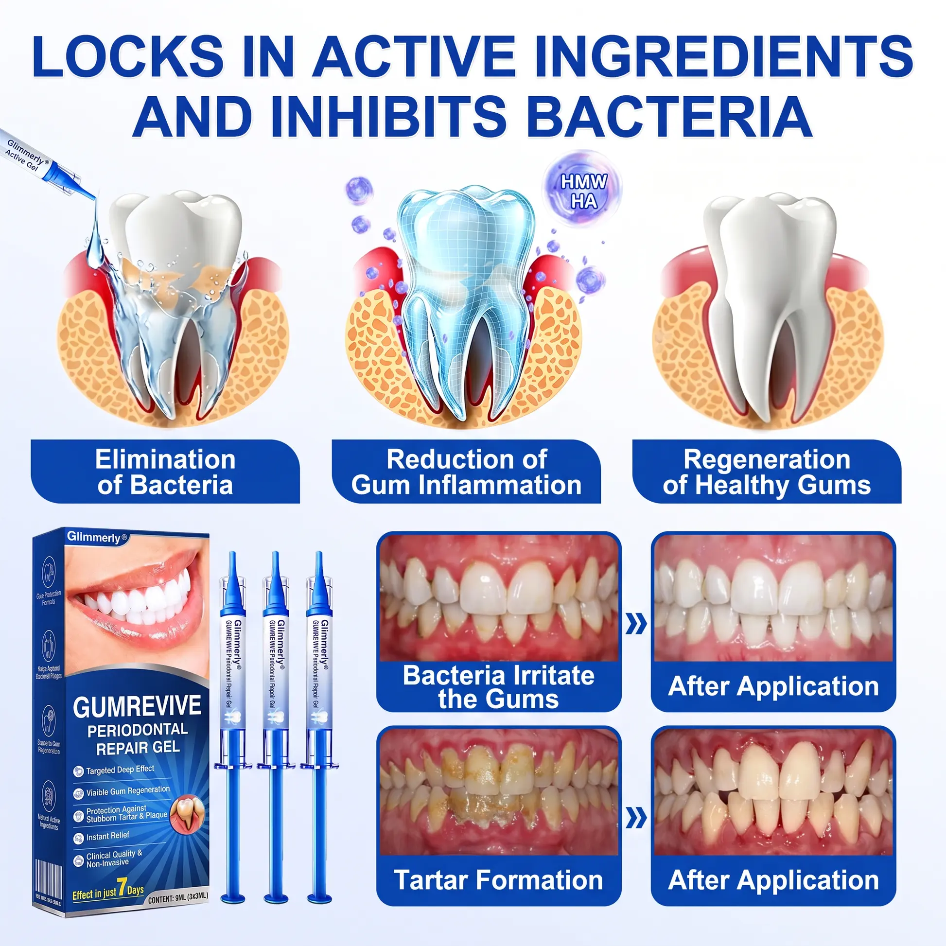 Glimmerly® GumRevive Periodontal Repair Gel