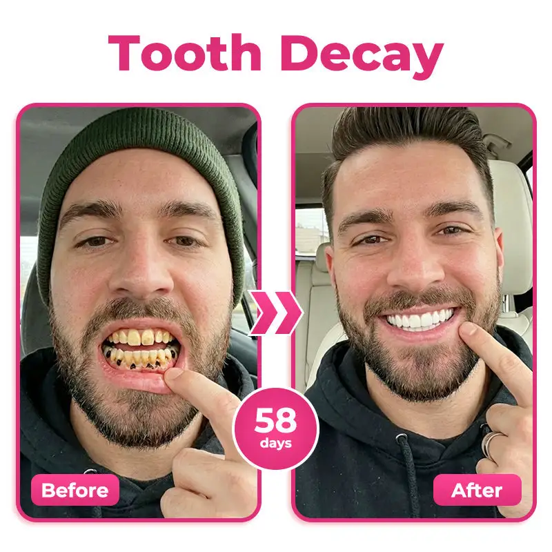enamel and gum therapy toothpaste serum