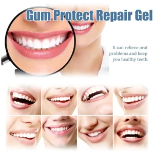 Nocztuce GumCare Support Gel