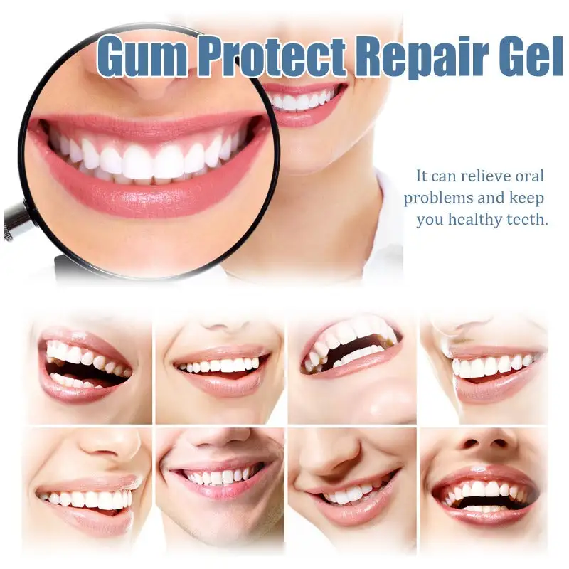 Nocztuce GumCare Support Gel
