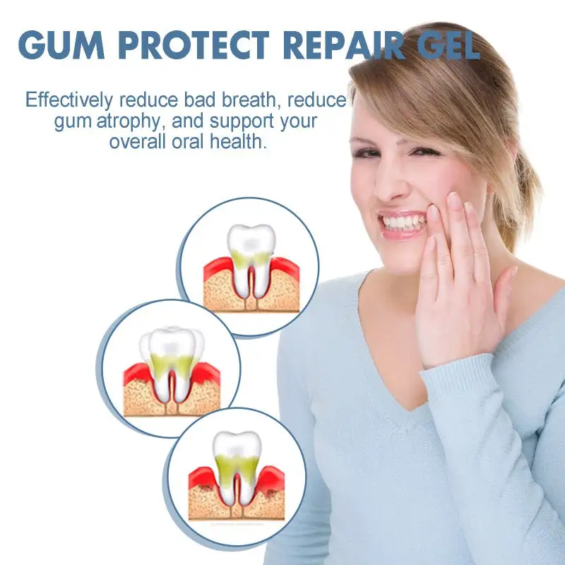 Nocztuce GumCare Support Gel