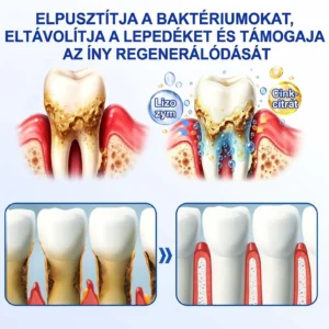 PureShade® GumRevive