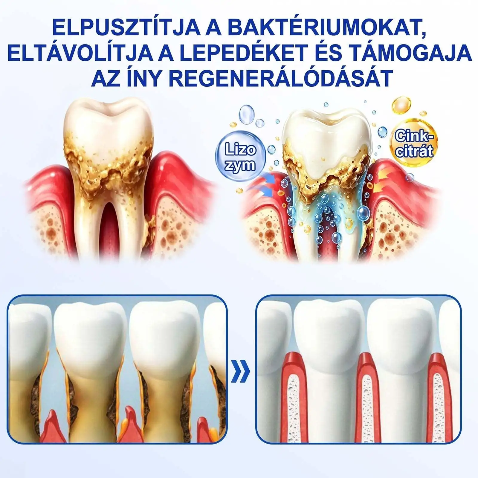 PureShade® GumRevive