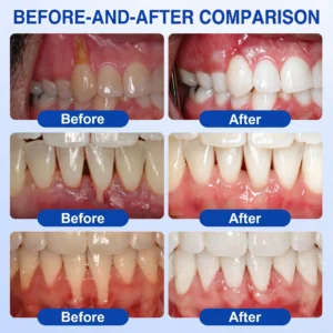 SOLAROZA® Gum Revive Periodontal Repair Gel