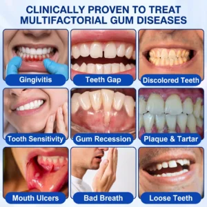 SOLAROZA® Gum Revive Periodontal Repair Gel