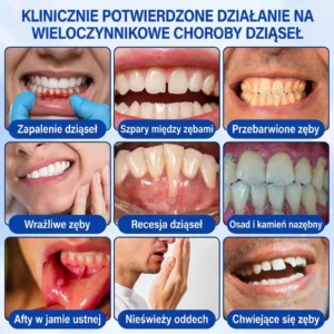 Vitalisys® GumRevive